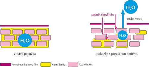 Popis obr.: Schéma pokožky s neporušenou a porušenou kožní bariérou